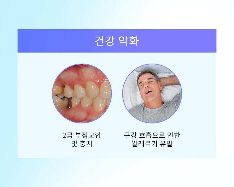 유형에 따라 달라지는 돌출입 수술 방법 관련 이미지 3