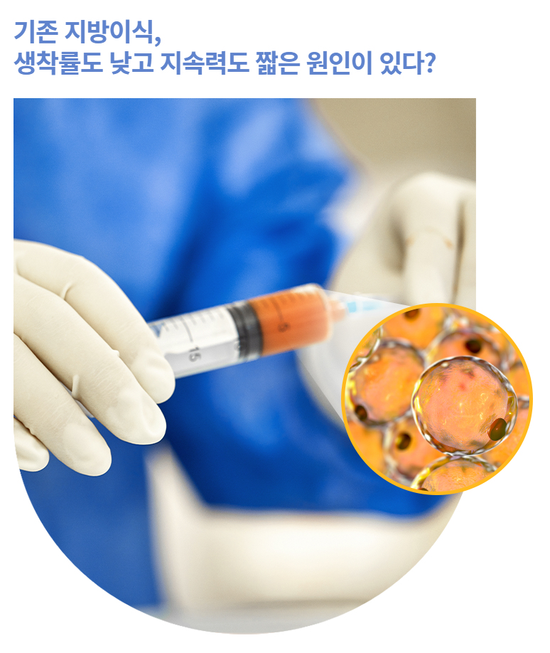 오래가는 아름다움, 줄기세포 지방이식 관련 이미지 2