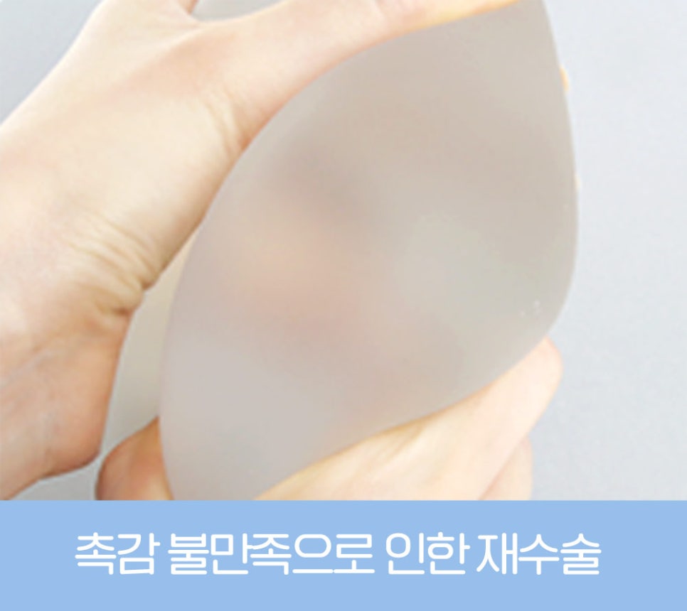 가슴 재수술, 원인에 따라 달라지는 개선 방법 관련 이미지 7