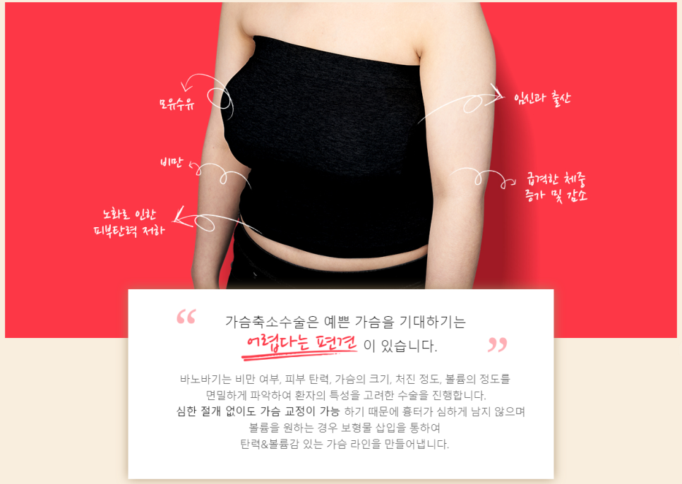 상체 지방흡입과 가슴 축소의 날씬한 조합! 듀얼슬림 관련 이미지 4