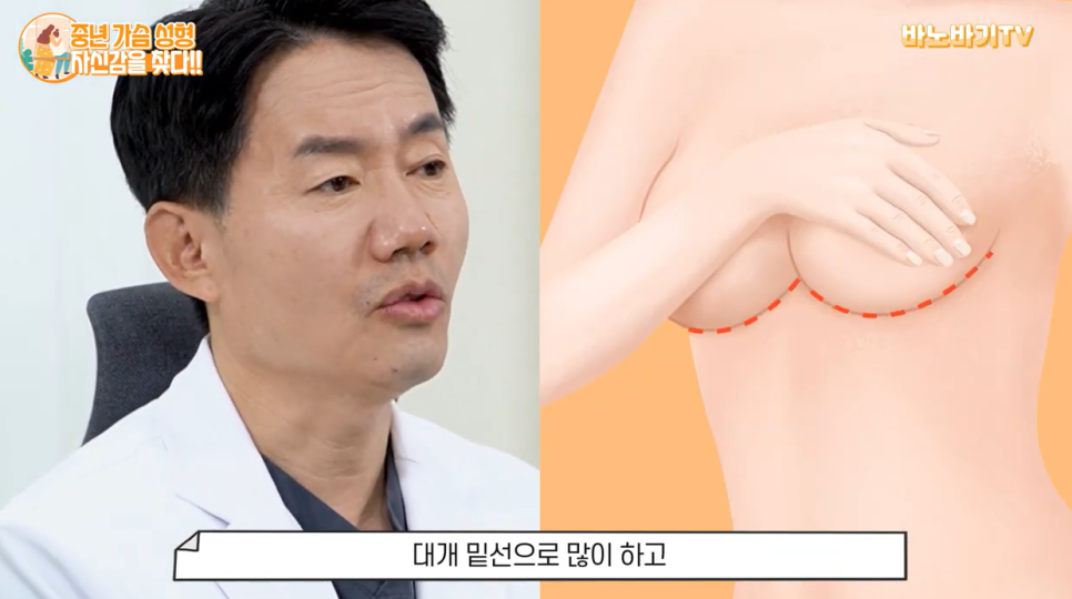 중년 가슴 성형도 만족스러운 결과를 얻을 수 있을까요? 관련 이미지 5