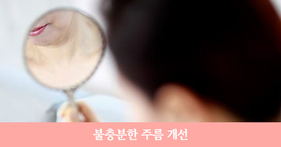 안면거상 재수술, 정확한 원인 분석으로 확실한 개선! 관련 이미지 3