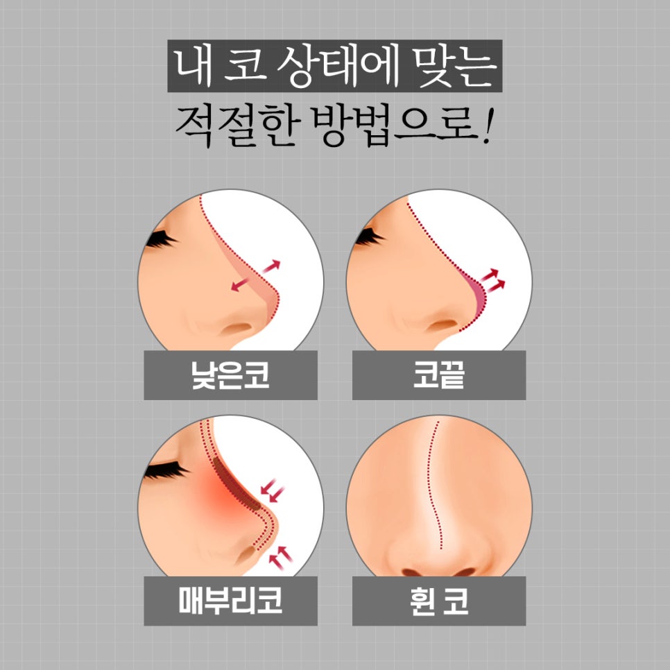 남자에게 맞는 코 성형과 개선 방법! 관련 이미지 3
