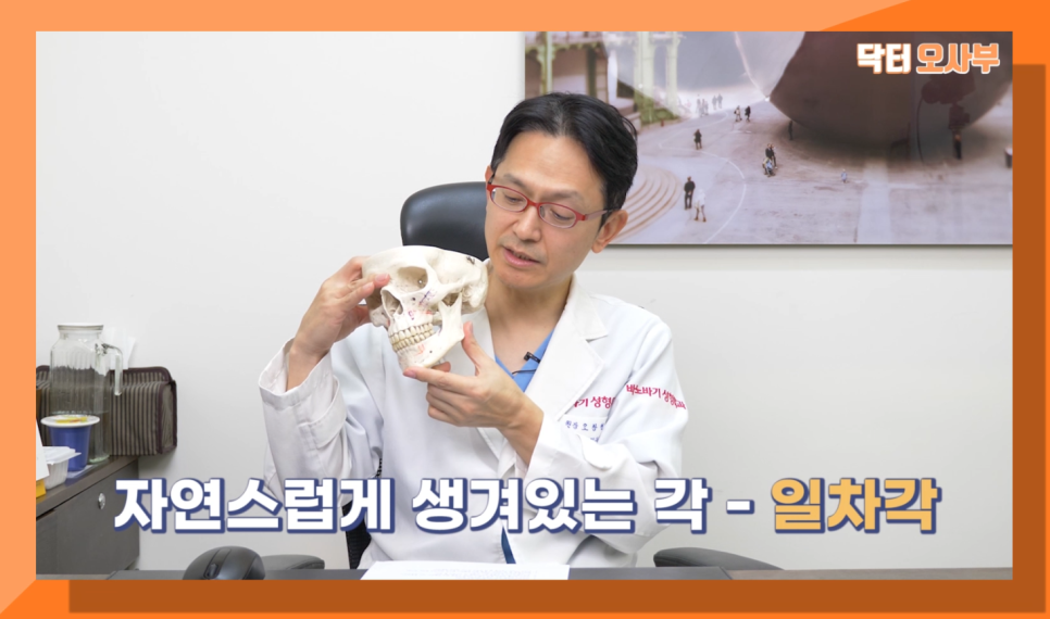 사각턱수술 부작용? 이차각? 닥터오사부랑 제대로 알아보자! 관련 이미지 3