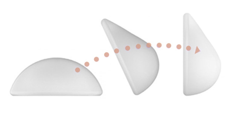 바노바기 가슴 성형, 모티바 더 퍼플이란? 관련 이미지 3