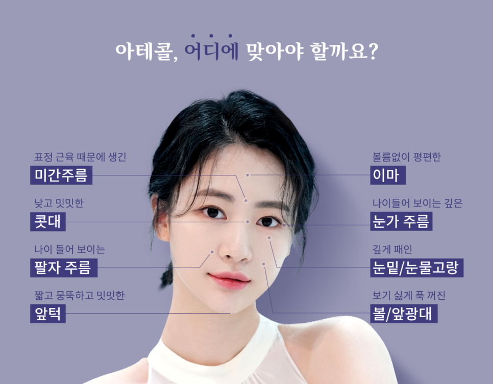 오래가는 아름다움, 반영구 필러 아테콜 관련 이미지 4