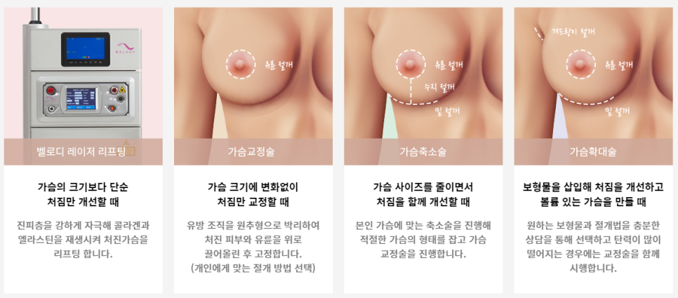 처진 가슴, 맞춤 개선으로 자신감 UP 관련 이미지 6