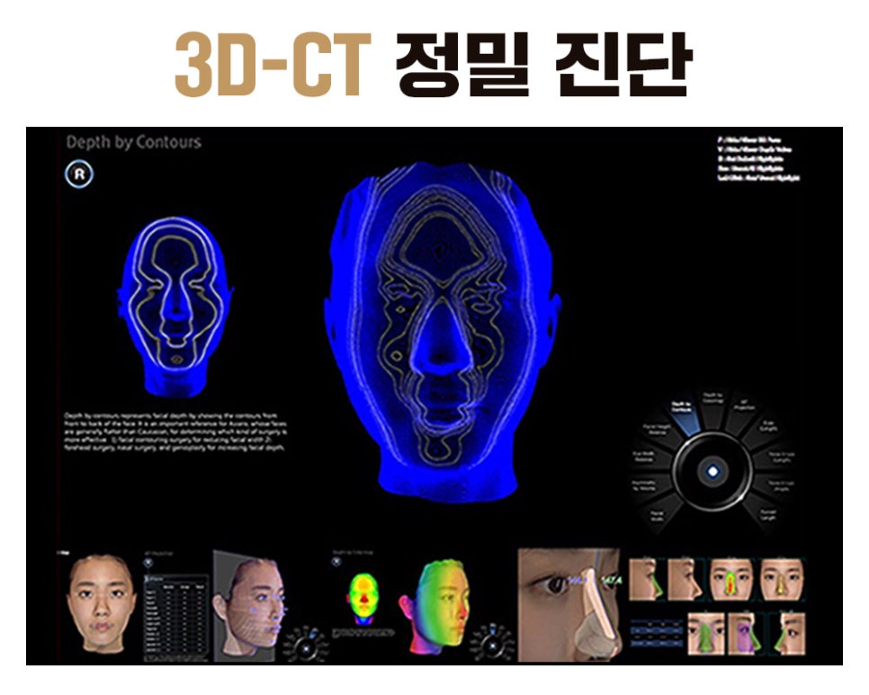 바노바기 코 성형, 나에게 어울리는 라인으로 한 번에 개선 관련 이미지 4