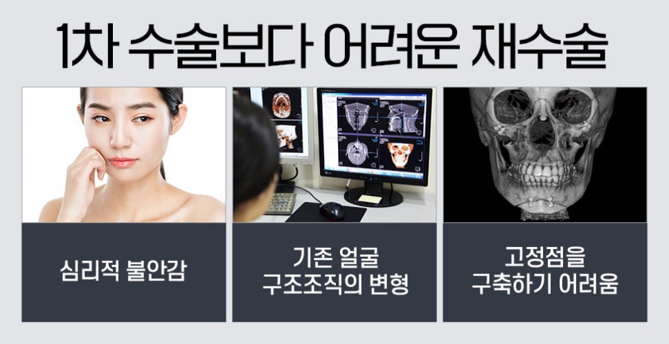 윤곽 재수술의 다양한 케이스와 수술 방법 관련 이미지 2