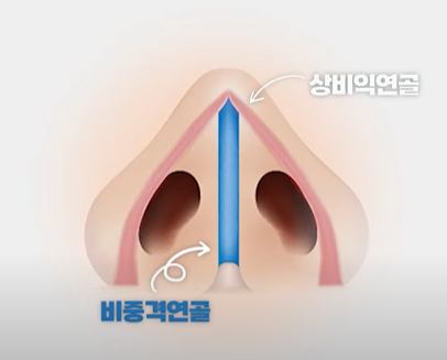 비밸브협착증, 코 막힘의 원인은? 관련 이미지 2