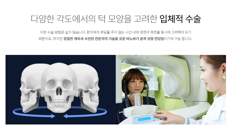 나에게 맞는 사각턱 수술 방법 찾기! 관련 이미지 4