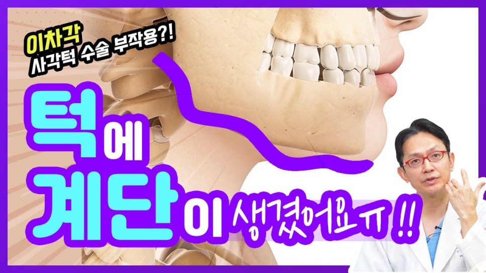 사각턱수술 부작용? 이차각? 닥터오사부랑 제대로 알아보자! 관련 이미지 1