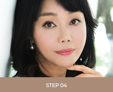 어떤 동안 성형보다 효과가 뛰어난 안면거상술 관련 이미지 6