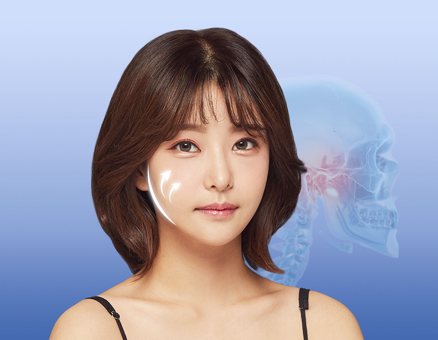 광대뼈축소 45도광대 이렇게 축소해야합니다! 관련 이미지 5