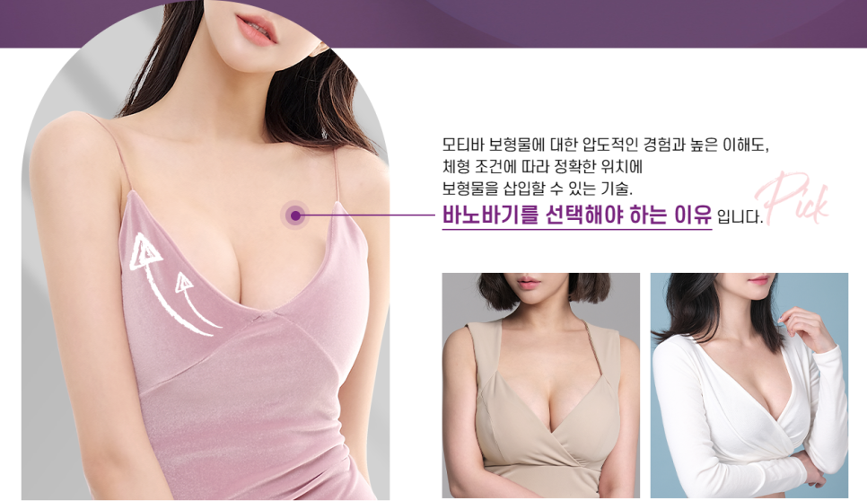 모티바가 촉감도 더 좋고 부작용도 적다?! 관련 이미지 3