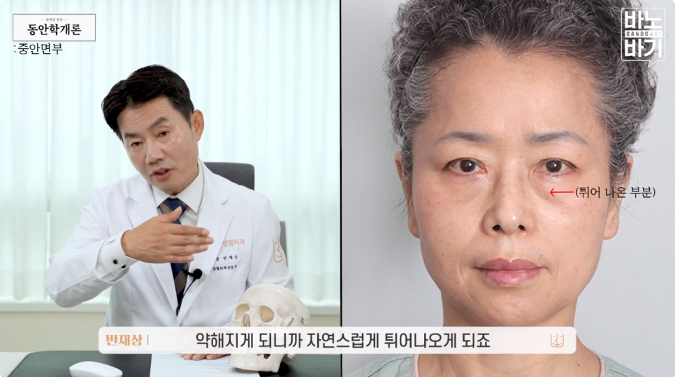 동안을 결정짓는 &lsquo;중안면부&rsquo; 노화 개선 방법! 관련 이미지 3