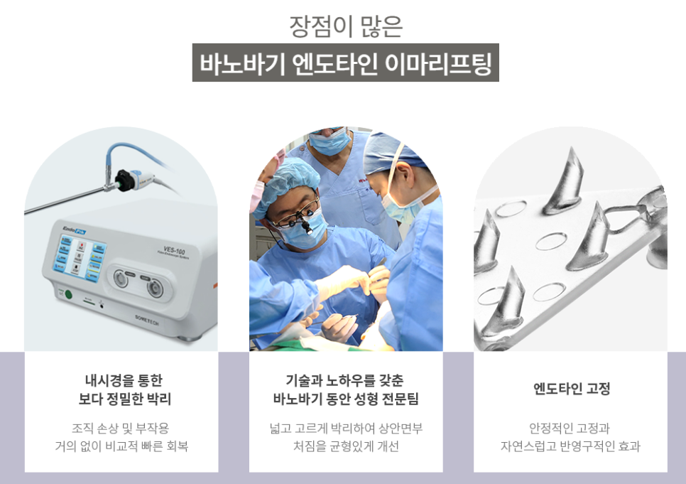 안전한 박리로 확실한 노화 개선을, 엔도타인 이마 리프팅 관련 이미지 4