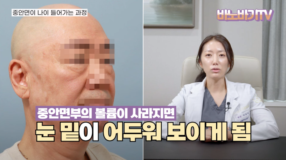 동안이 되고 싶다면? 중안면부를 잡아라! 관련 이미지 3