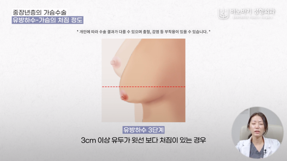 당신의 가슴은 원래 예뻤다, 중년 가슴성형 파헤치기! 관련 이미지 6