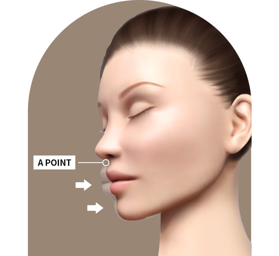 돌출입 정확한 진단으로 확실하게 개선하는 것이 중요! 관련 이미지 2