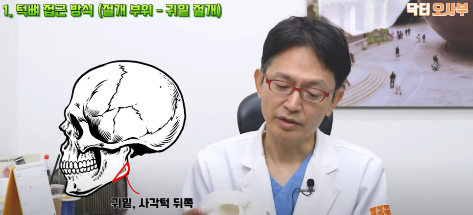 나에게 맞는 사각 턱 수술로 각진 턱과 넓은 얼굴을 개선하자! 관련 이미지 4