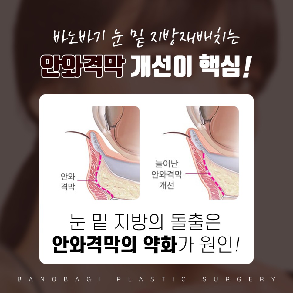 눈밑지방재배치유명한곳 경력을 봐야 실력을 압니다. 관련 이미지 2
