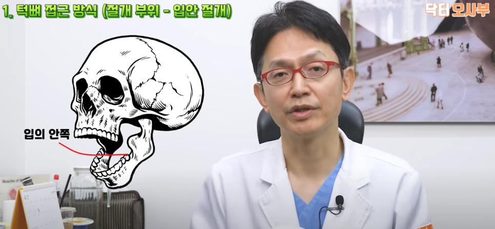 나에게 맞는 사각 턱 수술로 각진 턱과 넓은 얼굴을 개선하자! 관련 이미지 3