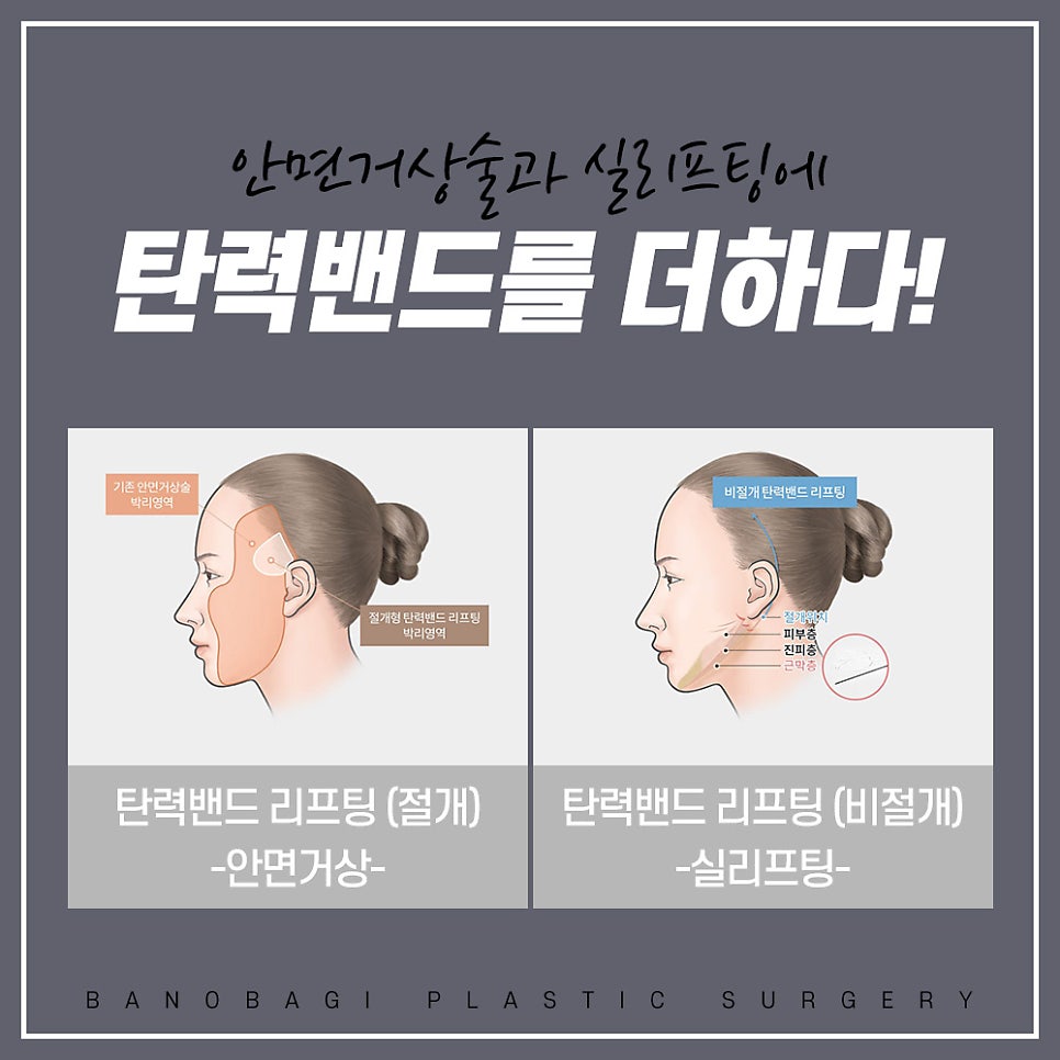 바노바기 탄력밴드 리프팅의 특징과 장점 관련 이미지 4