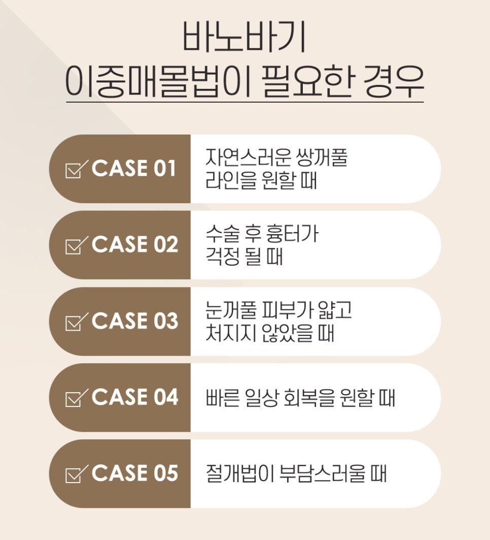 이중 매몰법의 장점과 기존 매몰법과의 차이점 관련 이미지 3