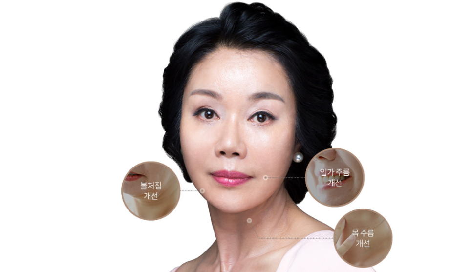 어떤 동안 성형보다 효과가 뛰어난 안면거상술 관련 이미지 2