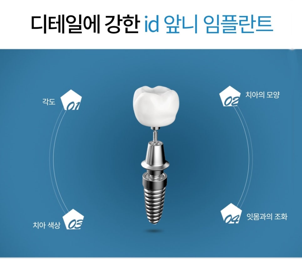 A Guide to Front Tooth Implant Treatment image 2