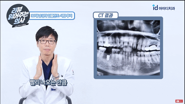 How to Easily Tell Which Places Are Good at Implants image 11