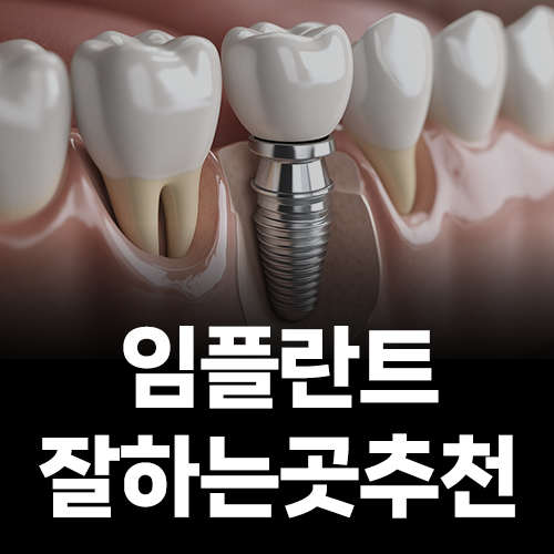 Recommended Place for Implants: How Can You Get It Done Properly the First Time? image 1