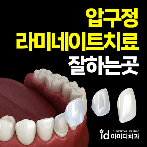압구정라미네이트치료잘하는곳 제대로 알아보기! 관련 이미지 1