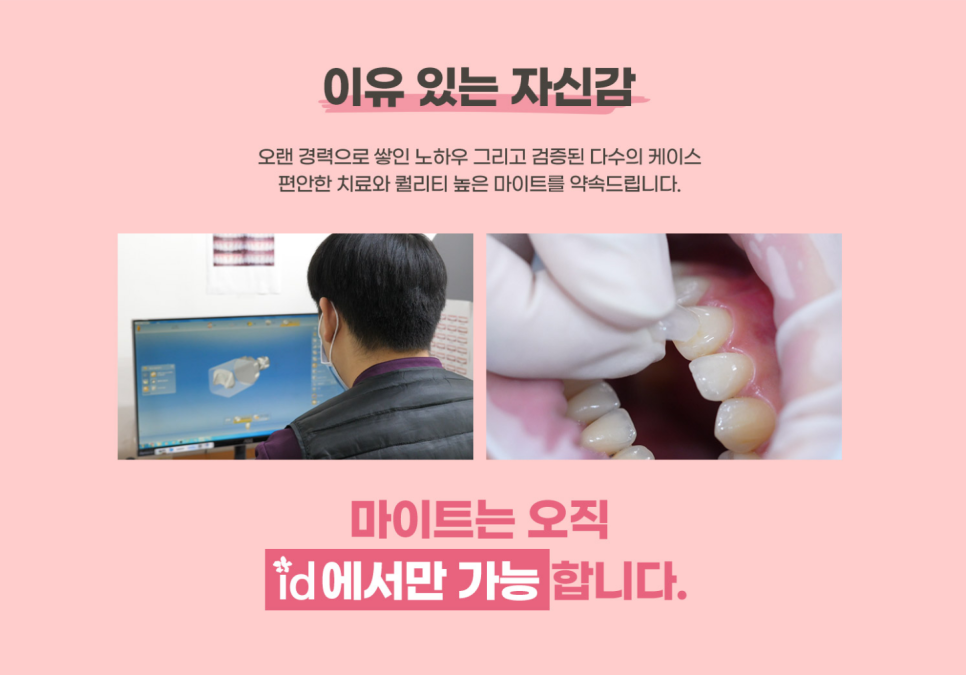 라미네이트 치료 전 알아두면 좋은 점 관련 이미지 5