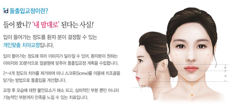 돌출입 치아교정, 수술없이 정상교합으로 관련 이미지 3