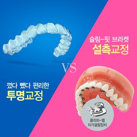 부분교정의 종류와 효과 관련 이미지 3