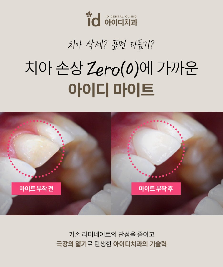 A Place That Considers the Health of Your Teeth for Veneers image 11