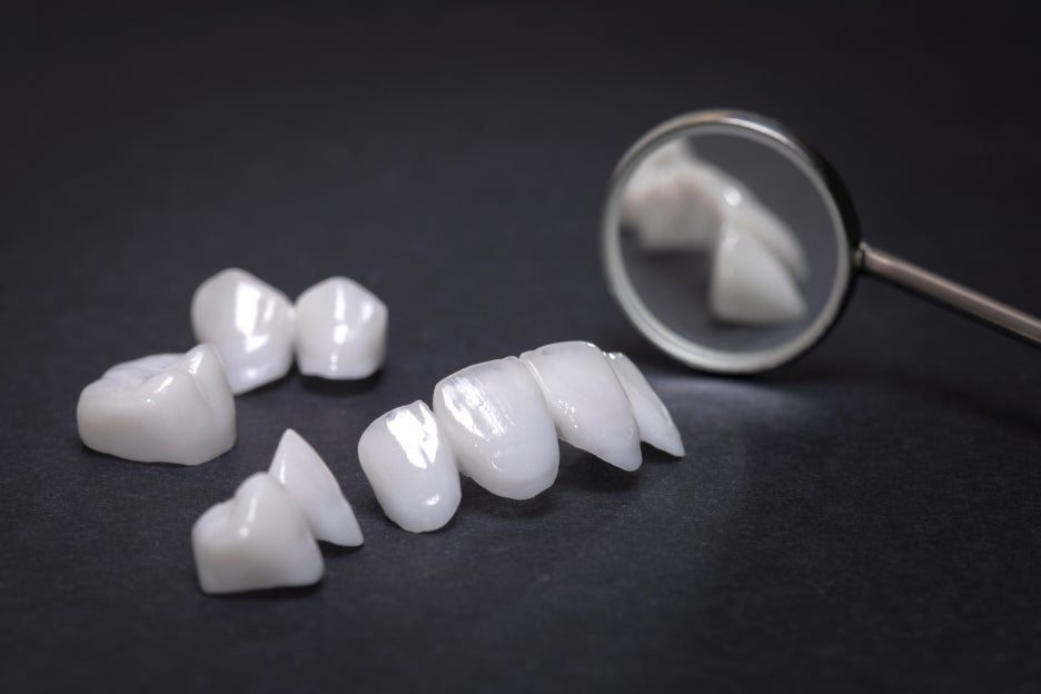 The Principles and Characteristics of Dental Laminates image 4