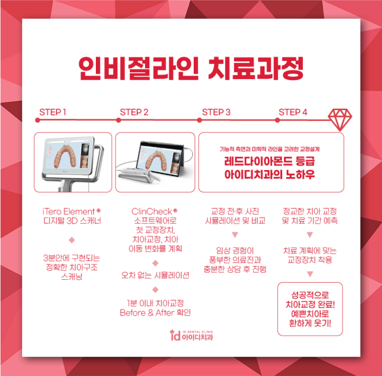 치아교정이 필요한 원인과 경우 관련 이미지 5
