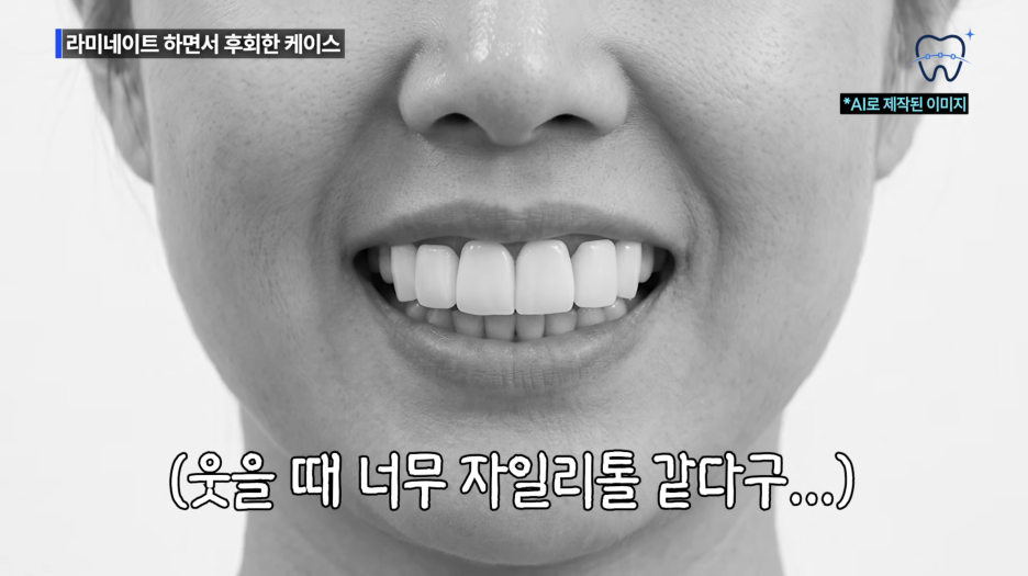 How to Make a Regret-Free Choice When Looking for a Recommended One-Day Laminate Dentist Near Nonhyeon Station image 9