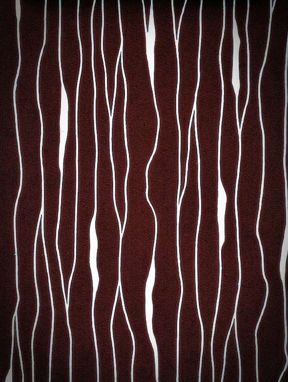 What Are the Conditions for Same-Day Laminate Veneers? image 28