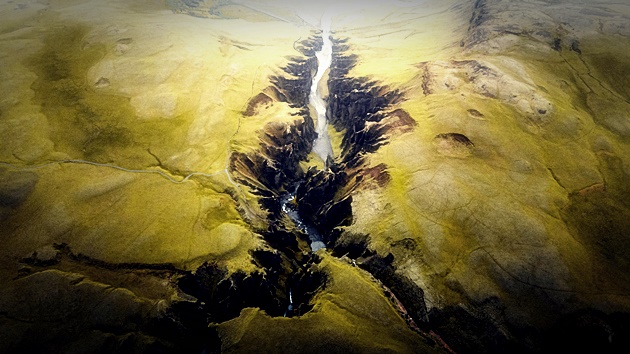 Recommended Place for Dental Implants That Reduces Fear image 32