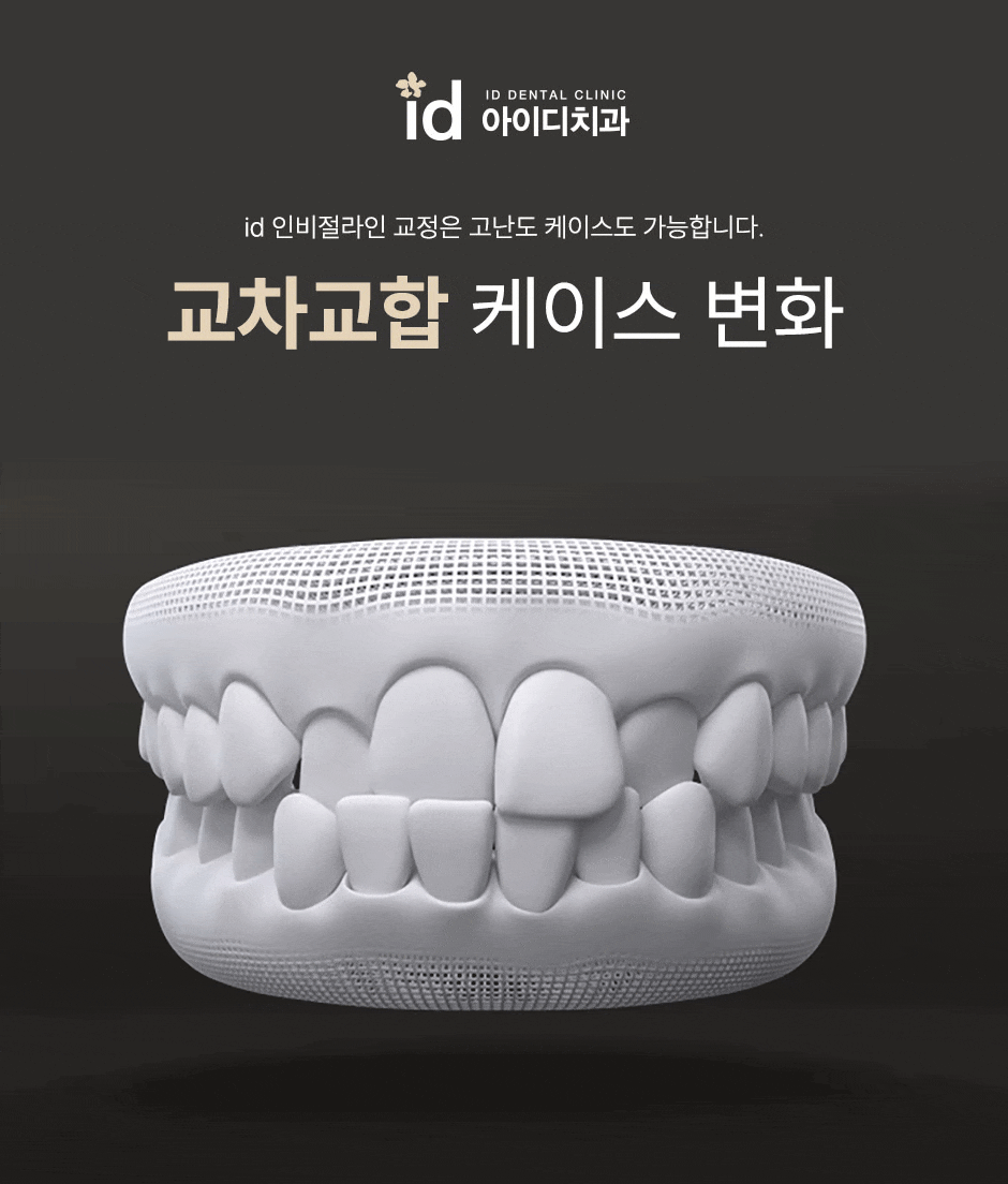 인비절라인가격 선택하기 전 알아두면 좋은 내용! 관련 이미지 14