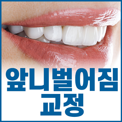 What Do You Think of This Device for Closing Gaps Between the Front Teeth? image 1