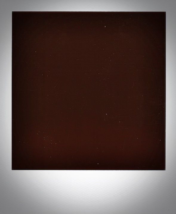 What Are the Conditions for Same-Day Laminate Veneers? image 32
