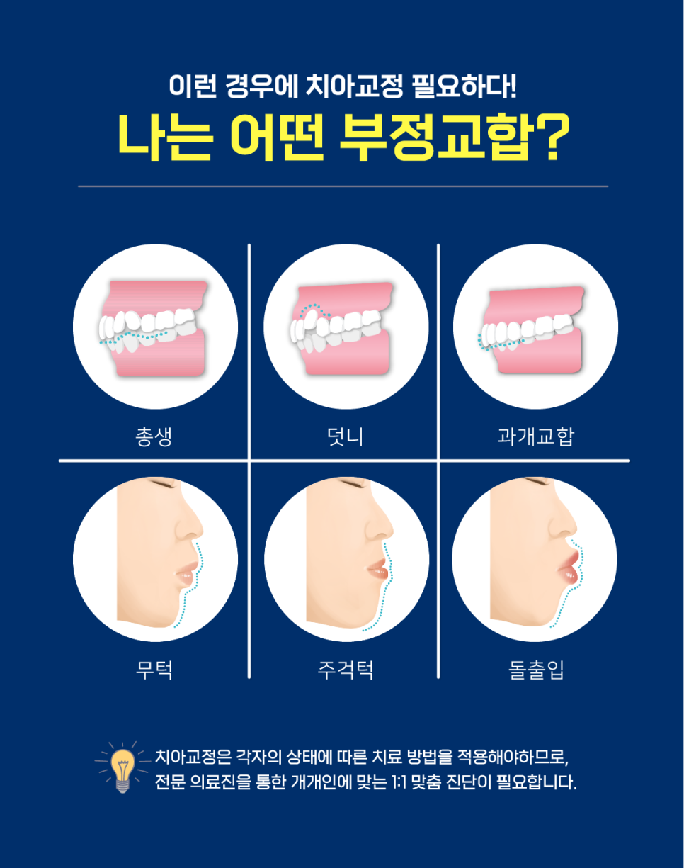 치아교정 꼭 확인해야 할 것은? 관련 이미지 5