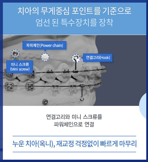 육지담교정 화제만발 예뻐진 그 비결 궁금하다면? 관련 이미지 5
