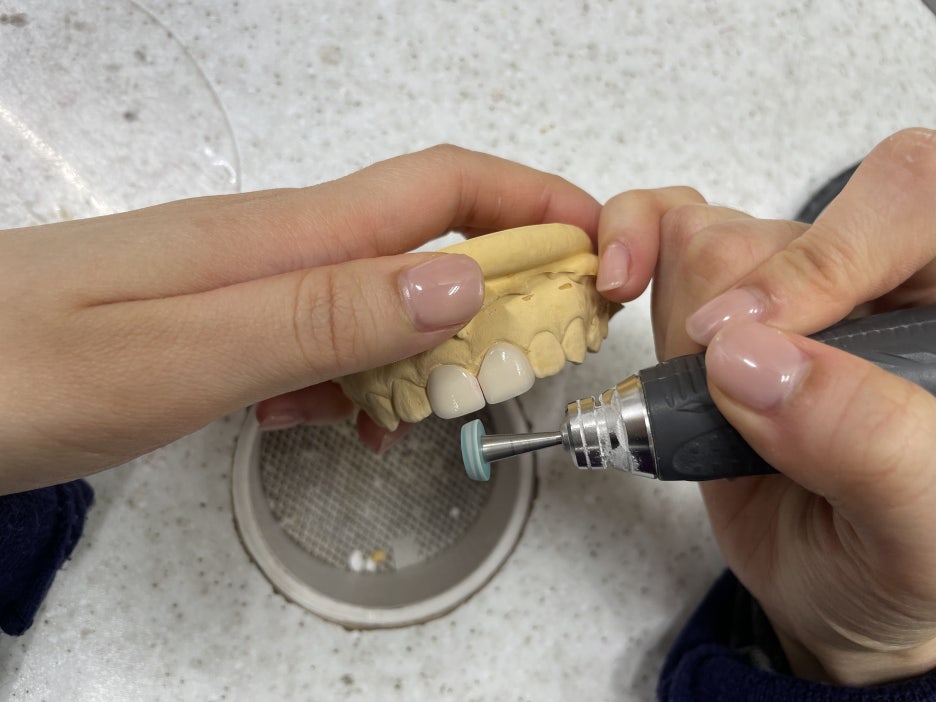 The Principles and Characteristics of Dental Laminates image 2