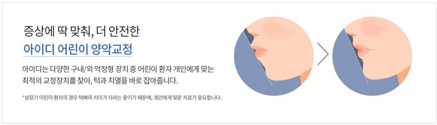 청소년치아교정 예민한 시기에 딱맞는 치료 여기서 찾자 관련 이미지 5
